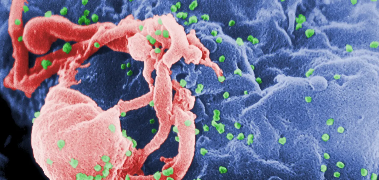 ৰাজ্যত ভয়াৱহ ৰূপত বৃদ্ধি পাইছে HIV আক্রান্তৰ সংখ্যা 