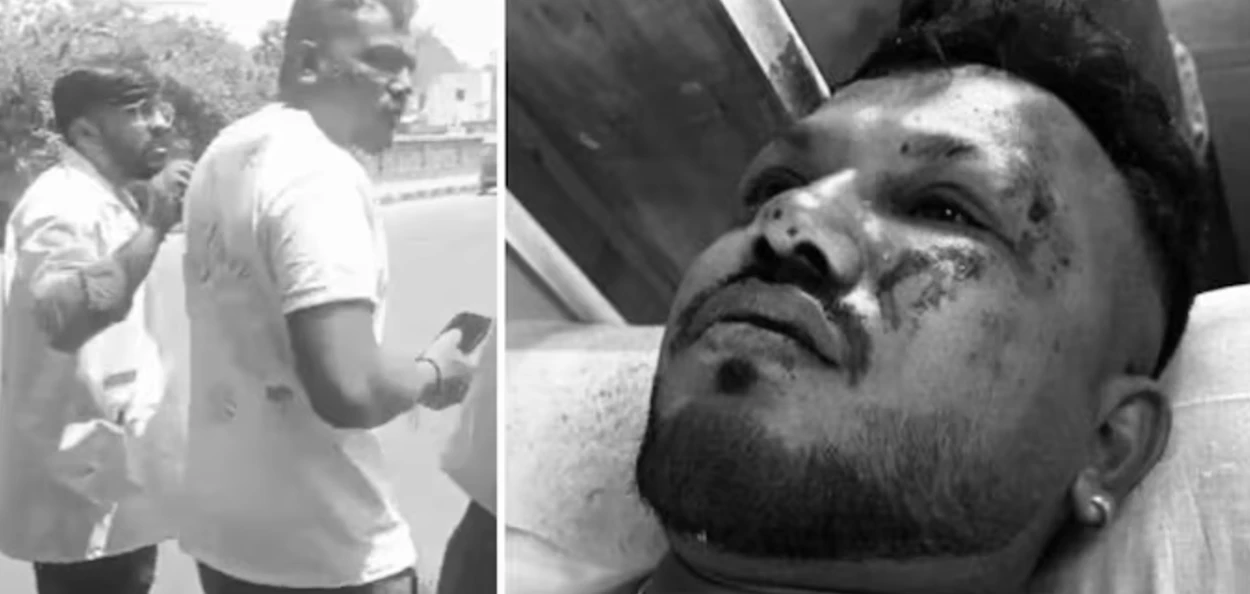 বিমান দূৰ্ঘটনাত অলৌকিকভাৱে প্ৰাণ ৰক্ষা পৰা ৰমেশ বিশ্বাসকুমাৰ