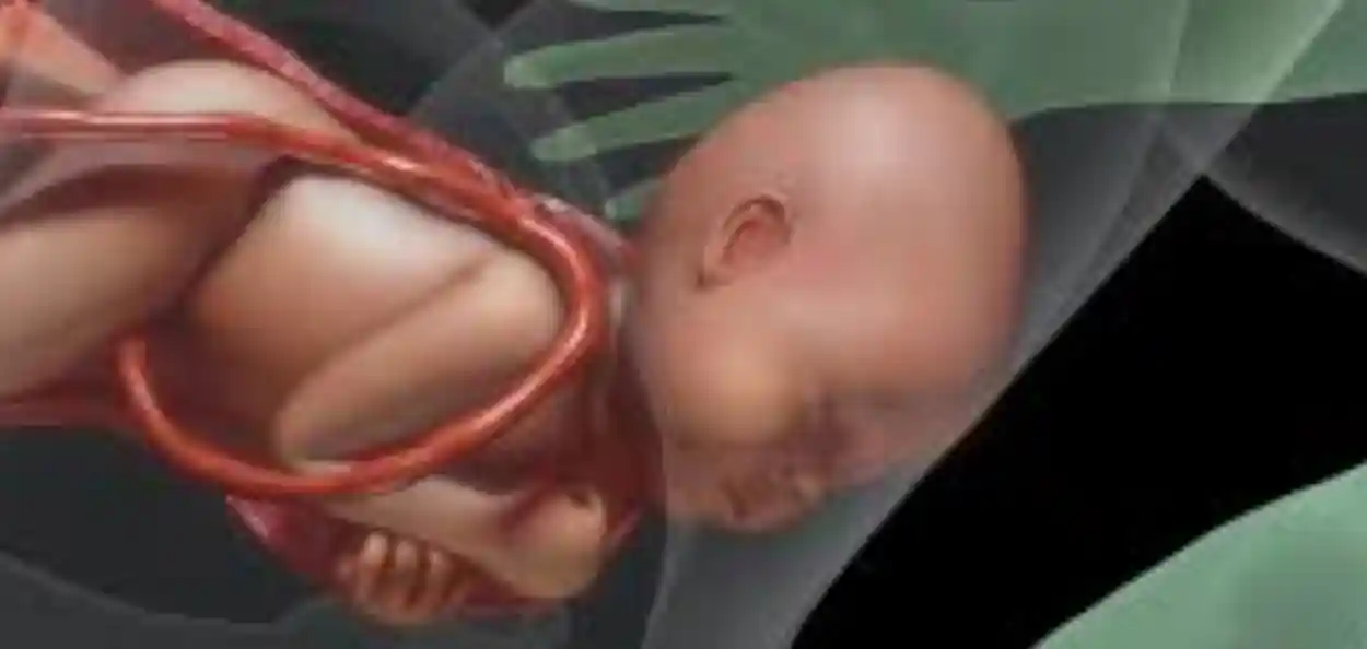 প্ৰতিনিধিত্বমূলক ছবি