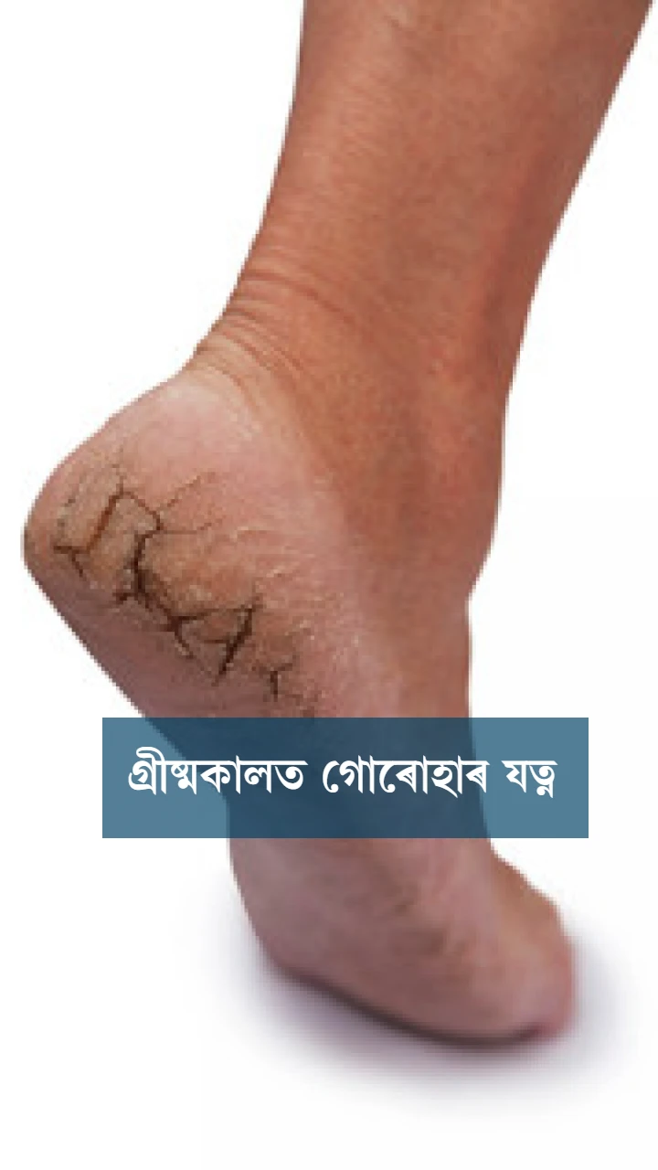 গ্ৰীষ্মকালত গোৰোহাৰ যত্ন  