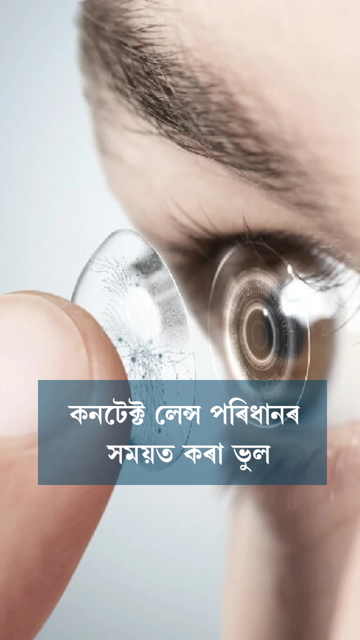 কনটেক্ট লেন্স পৰিধানৰ সময়ত কৰা ভুল